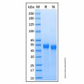 Recombinant Mouse Cathepsin C/DPPI Protein