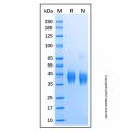 Recombinant Human BTN2A1/Butyrophilin 2A1 Protein