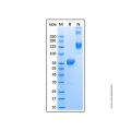 Recombinant Human Hip Protein