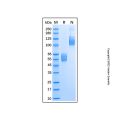 Recombinant Mouse Activin RIIB Protein