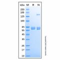 Recombinant Human Carboxylesterase 2/CES2 Protein