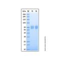 Recombinant Human Serpin F2/alpha 2-Antiplasmin Protein