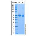 Recombinant Human Alkaline Phosphatase/ALPL Protein