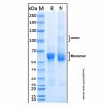 Recombinant Mouse WISP-1/CCN4 Protein