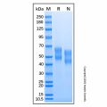 Recombinant Mouse IL-6R alpha Protein