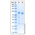 Recombinant Human Complement C1s Protein