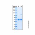 Recombinant Human YKL-40/CHI3L1 Protein