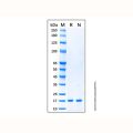 Recombinant Human Cystatin C Protein