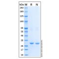 Recombinant Human Fatty Acid Synthase Protein