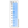 Recombinant Human mTOR Protein