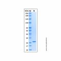 Recombinant Human HSP27 Protein