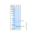 Recombinant Human IL-16 Protein
