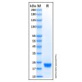 Recombinant Human IL-28B/IFN-lambda 3 Protein
