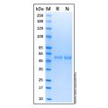 Recombinant Human Cytokeratin 20 Protein