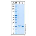 Recombinant Human FGF-21 Protein