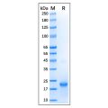 Recombinant Human GTPase HRAS Protein