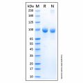 Recombinant Human FAP Protein