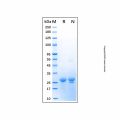 Recombinant Human MKI67 Protein