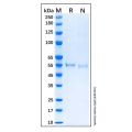 Recombinant Human p53 Protein