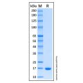 Recombinant Human IFN-alpha-2/IFNA2 Protein
