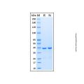 Recombinant Human Cytokeratin 19 Protein