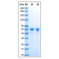 Recombinant Human ALDH1A1 Protein