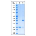 Recombinant Human Estrogen Receptor alpha Protein