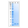 Recombinant Human SAA1 Protein