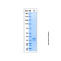 Recombinant Human IGF-I R/IGF1R Protein