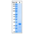 Recombinant Human p27 KIP 1 Protein