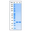 Recombinant Human Heme Oxygenase 1 Protein