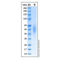 Recombinant Human CD200R1 Protein
