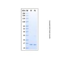 Recombinant Human IL-36 gamma/IL-1F9 Protein