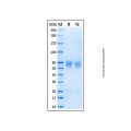 Recombinant Human MMP-8 Protein