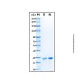 Recombinant Human Cardiotrophin-1/CT-1 Protein