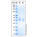 Recombinant Human uPAR Protein
