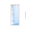 Recombinant Mouse CXCL1/KC Protein