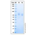 Recombinant Human ALCAM/CD166 Protein