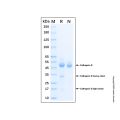 Recombinant Human Cathepsin D Protein