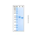 Recombinant Human DLL1 Protein