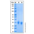 Recombinant Human VSIG3 Protein
