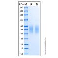 Recombinant Human 5T4/TPBG Protein