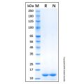 Recombinant Human FABP1/L-FABP Protein