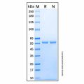 Recombinant Human PKLR Protein
