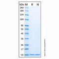Recombinant Human S100 alpha 6/PRA Protein