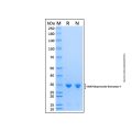 Recombinant Human Superoxide Dismutase 1 Protein
