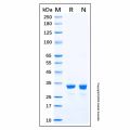 Recombinant Human SULT1B1 Protein