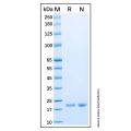 Recombinant Human Ube2H Protein
