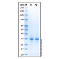 Recombinant Human PARP-1 Protein