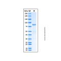 Recombinant Human SDHA Protein
